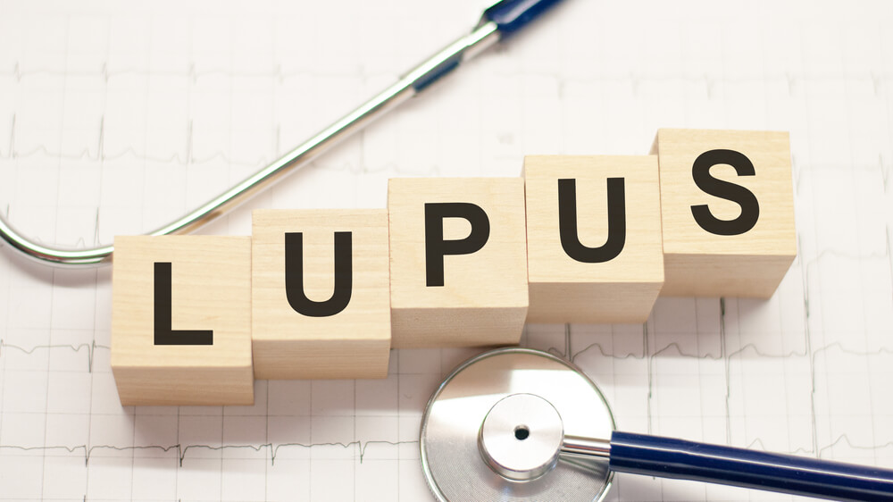 Natural Treatments for Lupus
